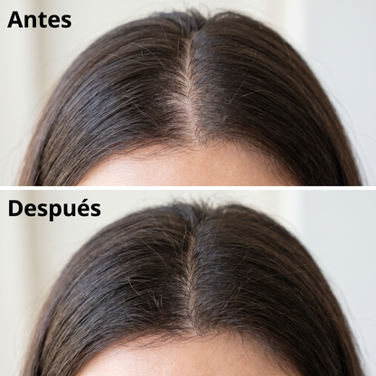 Barra Coreana Anticaída Yonura