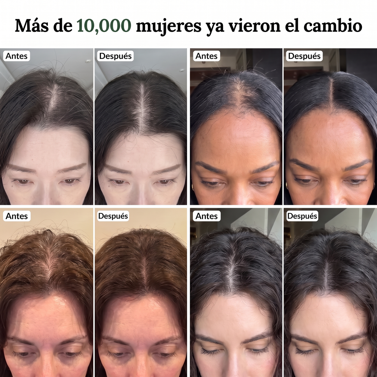 Barra Coreana Anticaída Yonura