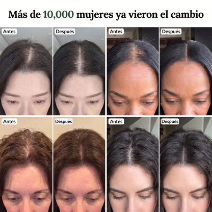 Barra Coreana Anticaída Yonura